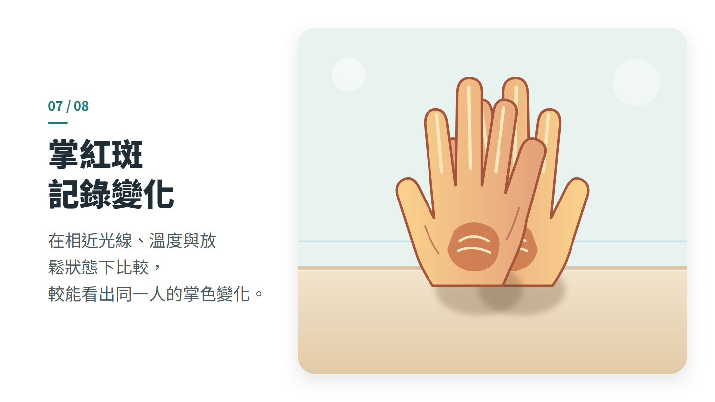 掌紅斑 記錄變化
