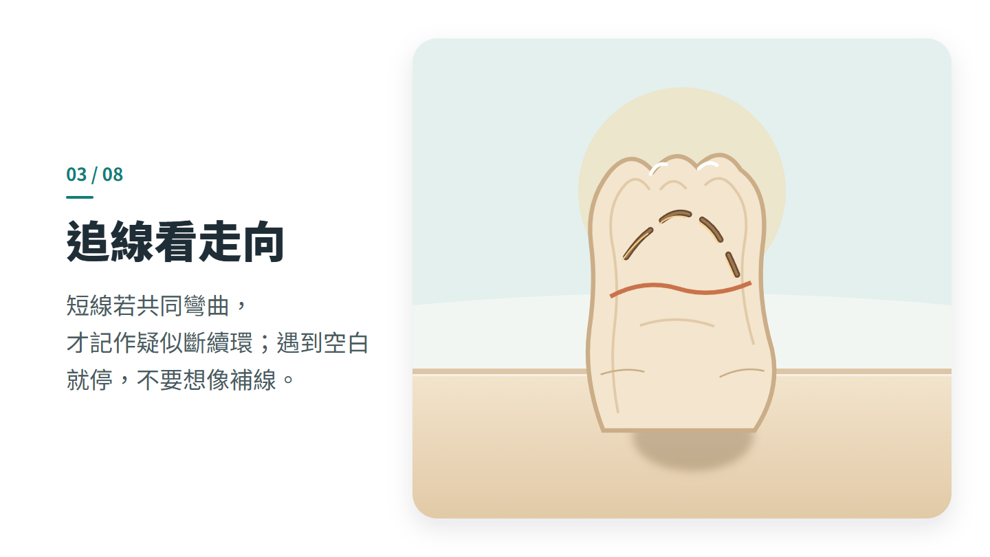 追線看走向